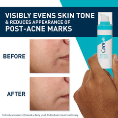 Sérum Retinol Anti-Marcas